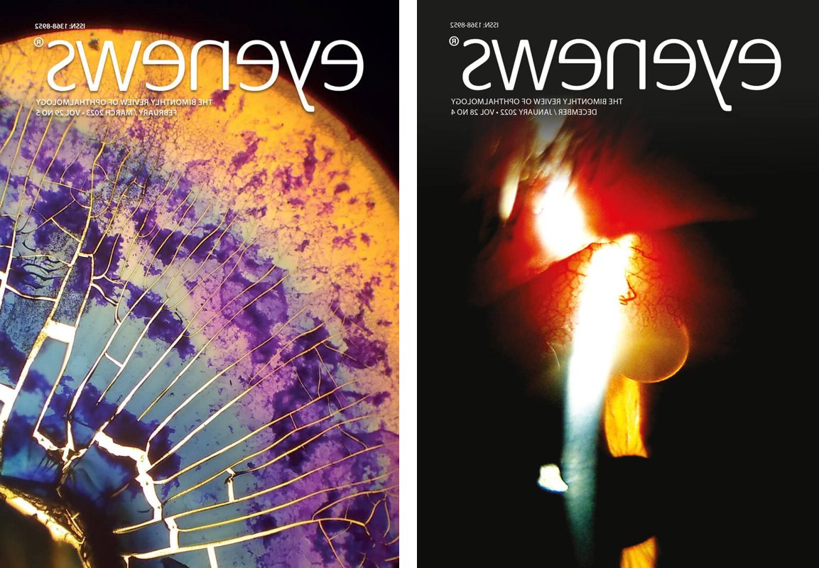 www eyexcon.com Community Engagement and Outreach